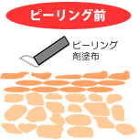 �s�[�����O�O